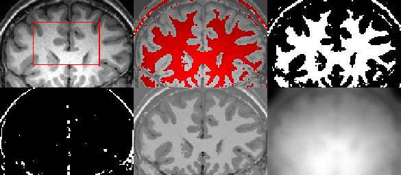 brain segmentation